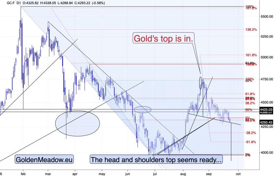 Gold at the Neckline as Yields Hit 2007 Highs - Image 2