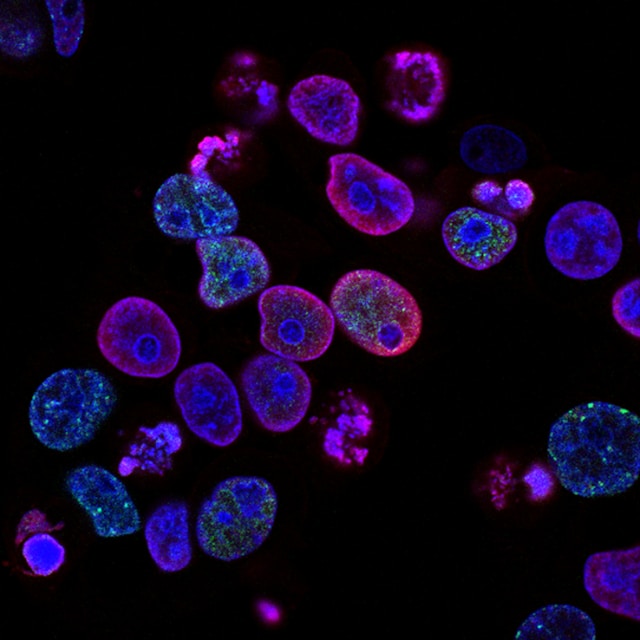 national-cancer-institute-L7en7Lb-Ovc-unsplash.jpg
