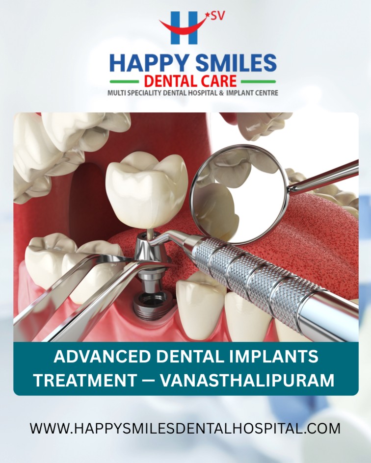Advanced Dental Implants Treatment — Vanasthalipuram.jpg Advanced Dental Implants Treatment — Vanasthalipuram.jpg