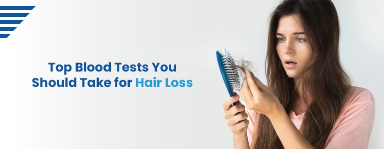 top-blood-tests-you-should-take-for-hair-loss (1) (1).jpg top-blood-tests-you-should-take-for-hair-loss (1) (1).jpg