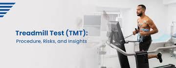 treadmill test.jpg
