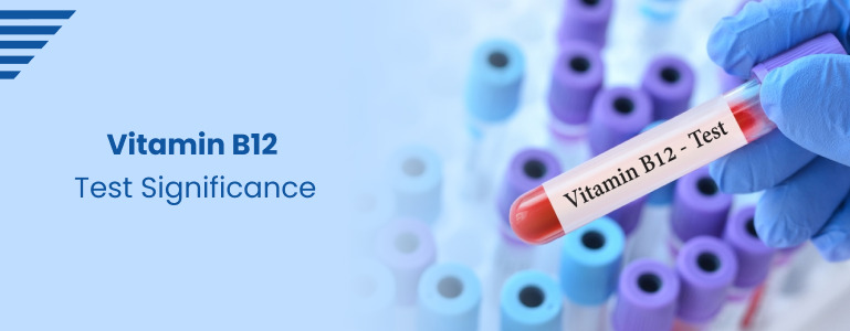 vitamin-b12-test-significance.jpg