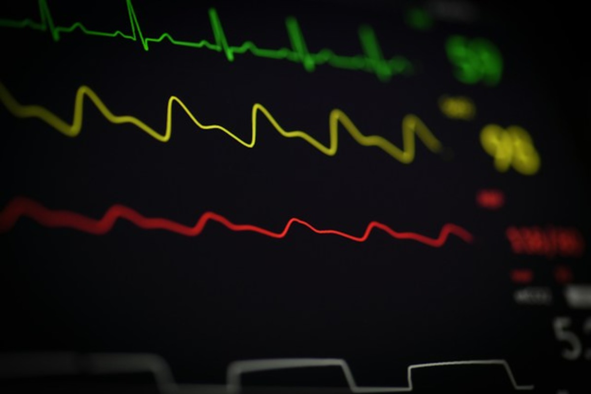 Market Pulse - Wednesday, Sept. 30