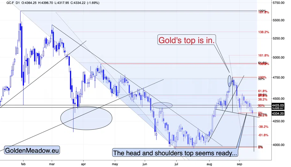 Gold Slides After The Meeting That Did Not Happen - Image 2