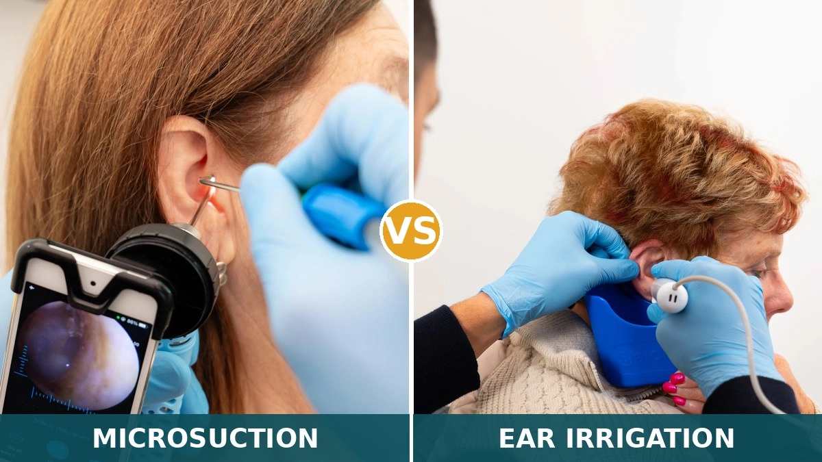 microsuction-vs-ear-irrigation.jpg