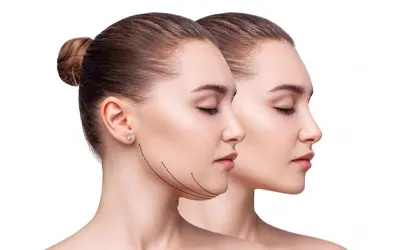 Double-Chin-Treatment-2.webp Double-Chin-Treatment-2.webp